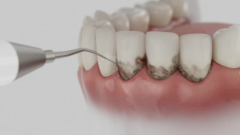 Trusted Emergency Dentist service in Ashtabula, OH - Dentist Open Now